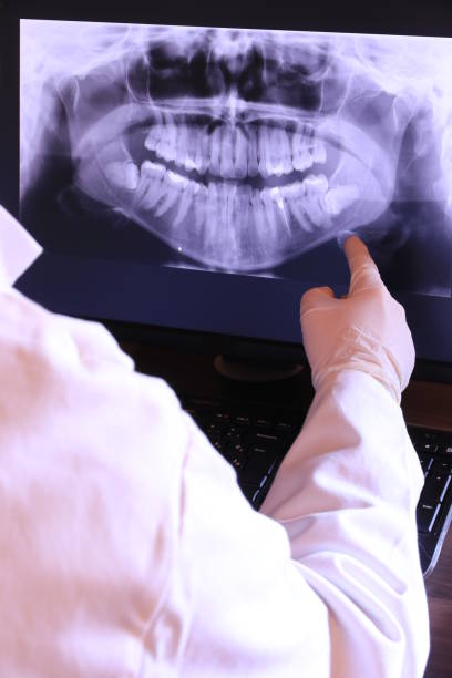 Best Emergency Dental Care for Broken or Chipped Teeth in Pleasant Hill, PA