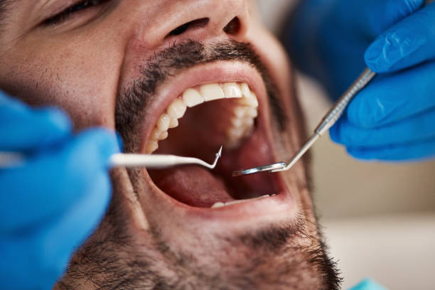 Best Emergency Gum Treatment in Pleasant Hill, PA