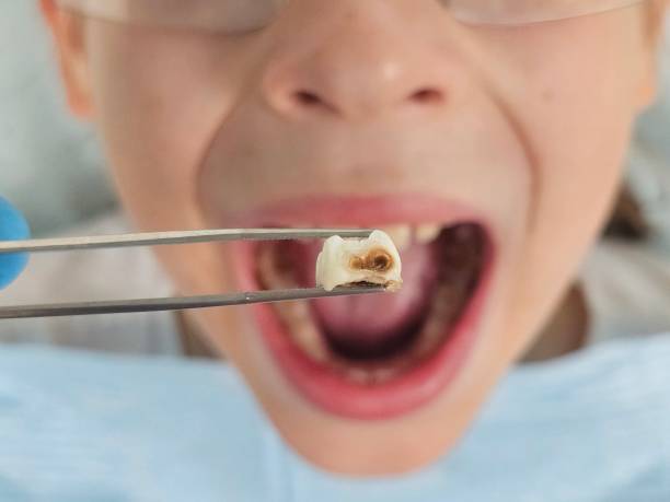 Best Pediatric Emergency Dentist in Pleasant Hill, PA